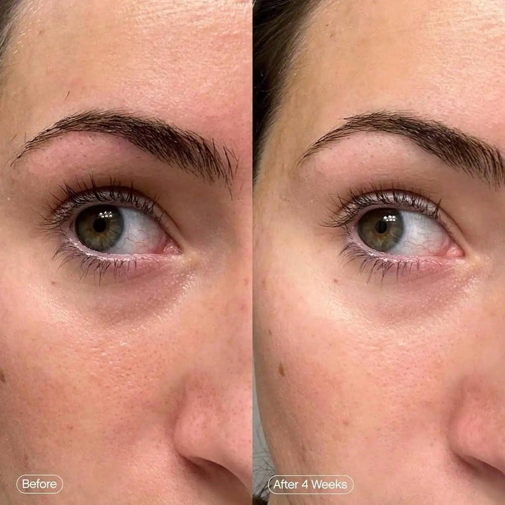 Fade and brighten Under eye Patches